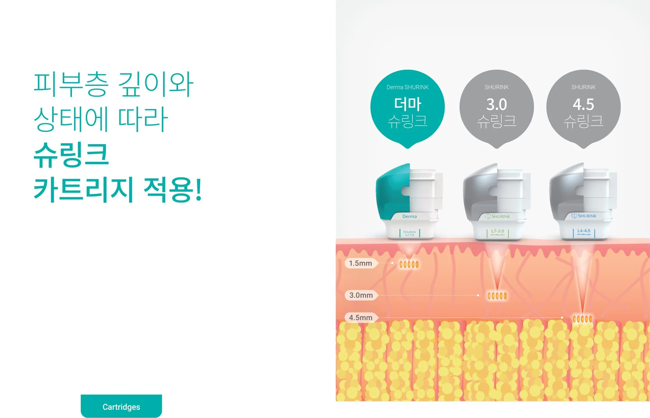 멀티 슈링크리프팅3 멀티 슈링크리프팅3