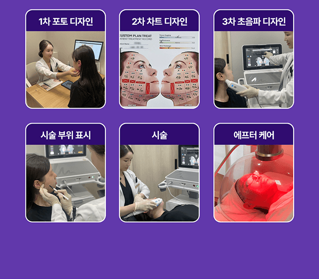 울쎄라 프라임 홈페이지 상세페이지 제작_10-2 울쎄라 프라임 홈페이지 상세페이지 제작_10-2