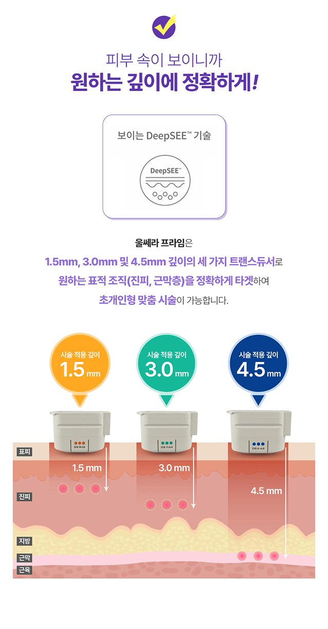 [크기변환]울쎄라 프라임 홈페이지 상세페이지 제작_4