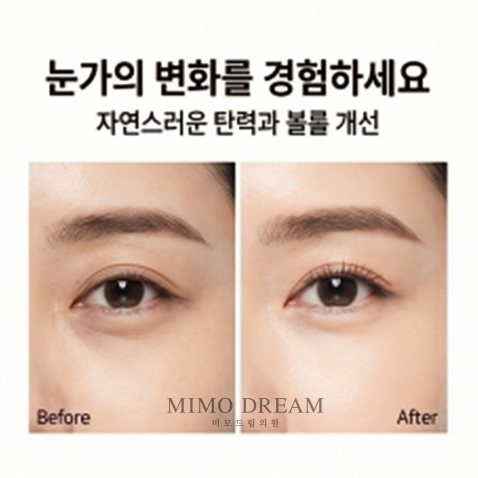 [크기변환]쥬베룩아이4