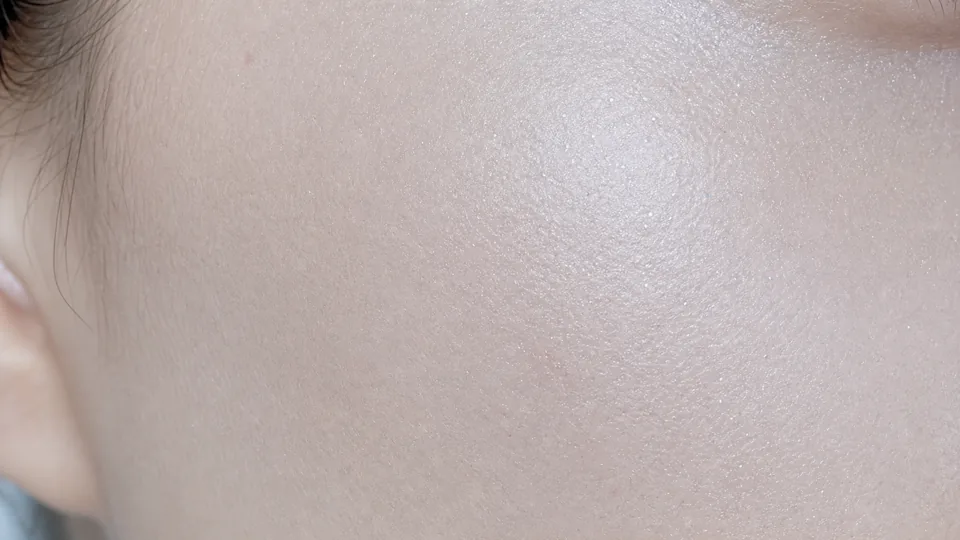 플래티넘 PTT — 여드름·흉터 라인업 카드