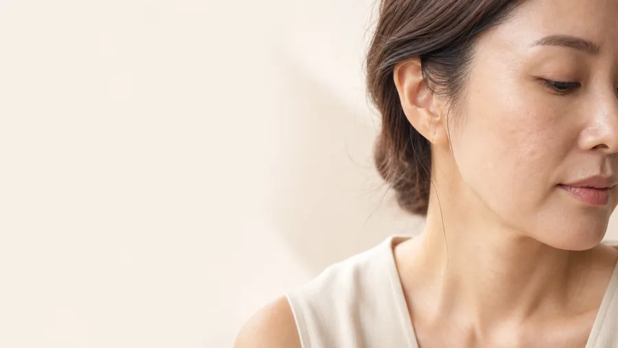 여드름·흉터 — 단계별 진단 프레임 비주얼